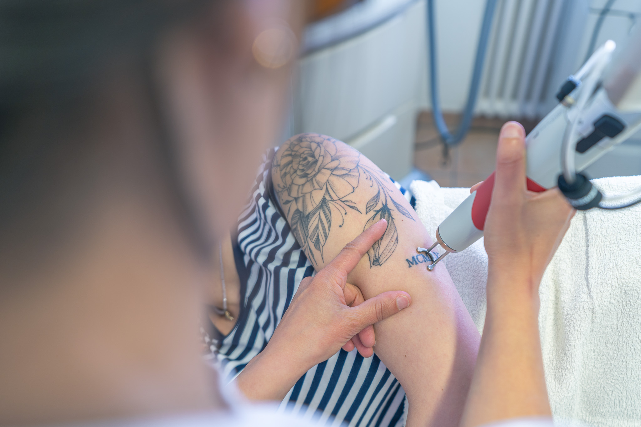 Come si svolge un trattamento laser