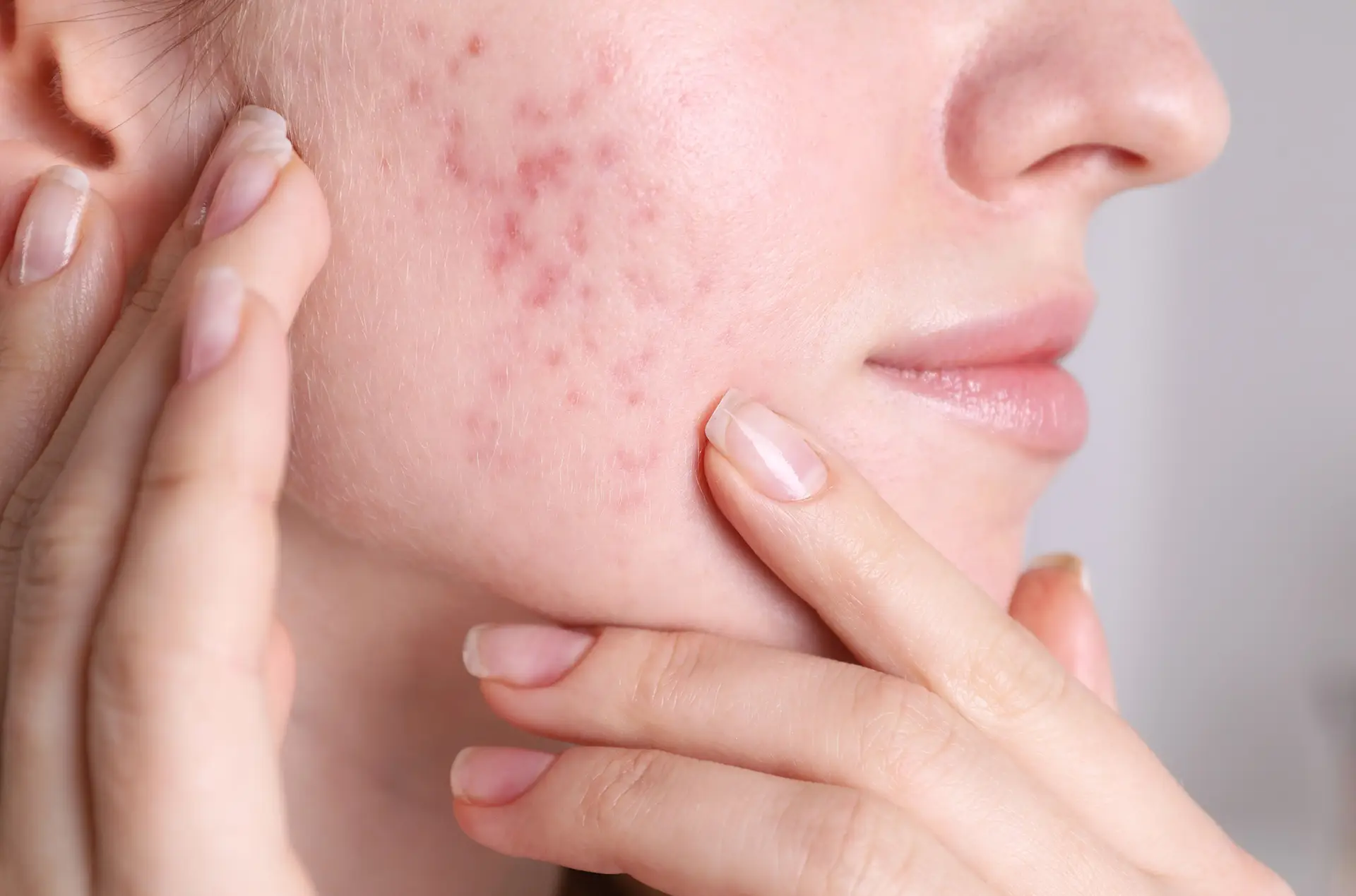 Domande frequenti — dermatologia