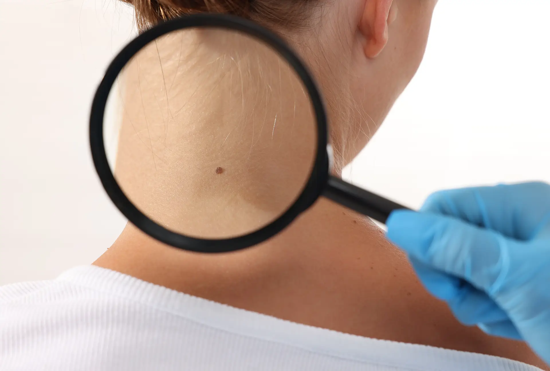 Dermatologia — la pelle