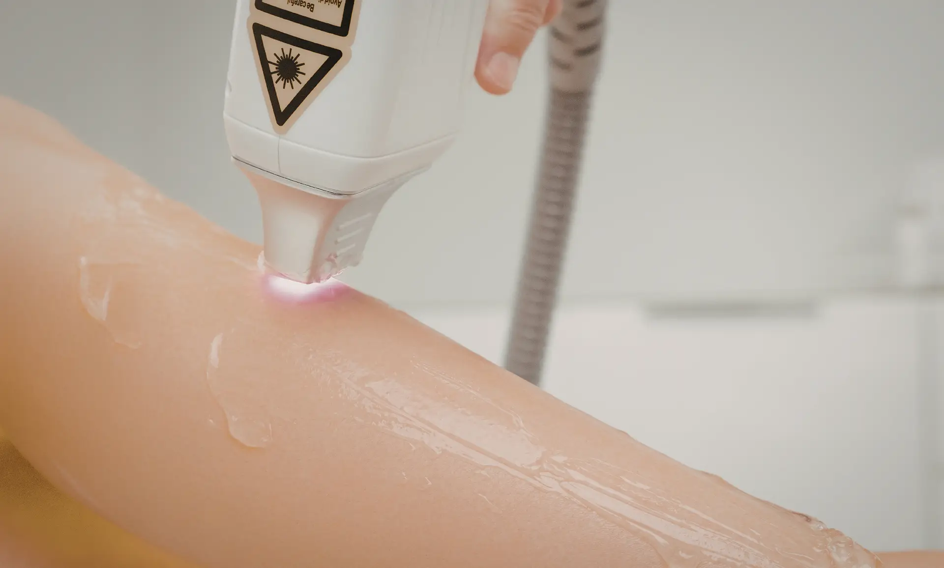 Laserterapia — tecnologia avanzata